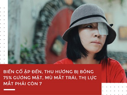 Nữ sinh bị tạt axit ở Sài Gòn: Tình yêu chợt đến khi đời tăm tối nhất!